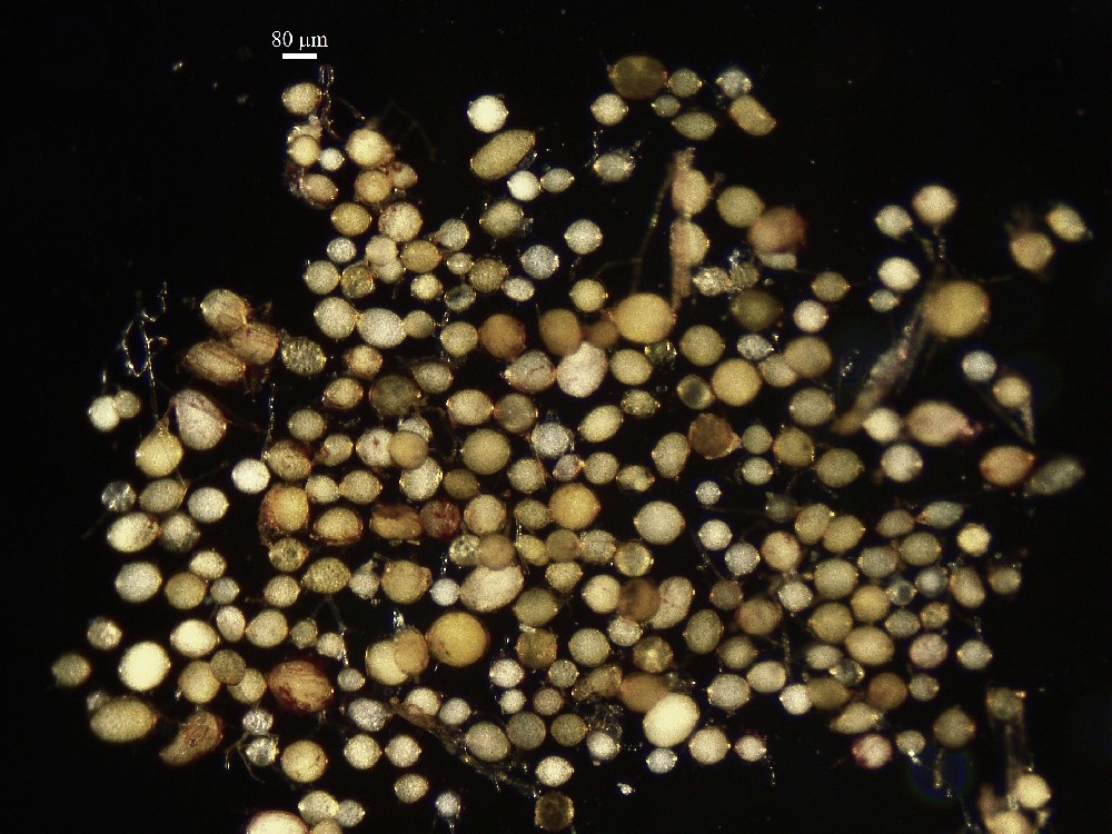 Rhizophagus irregularis